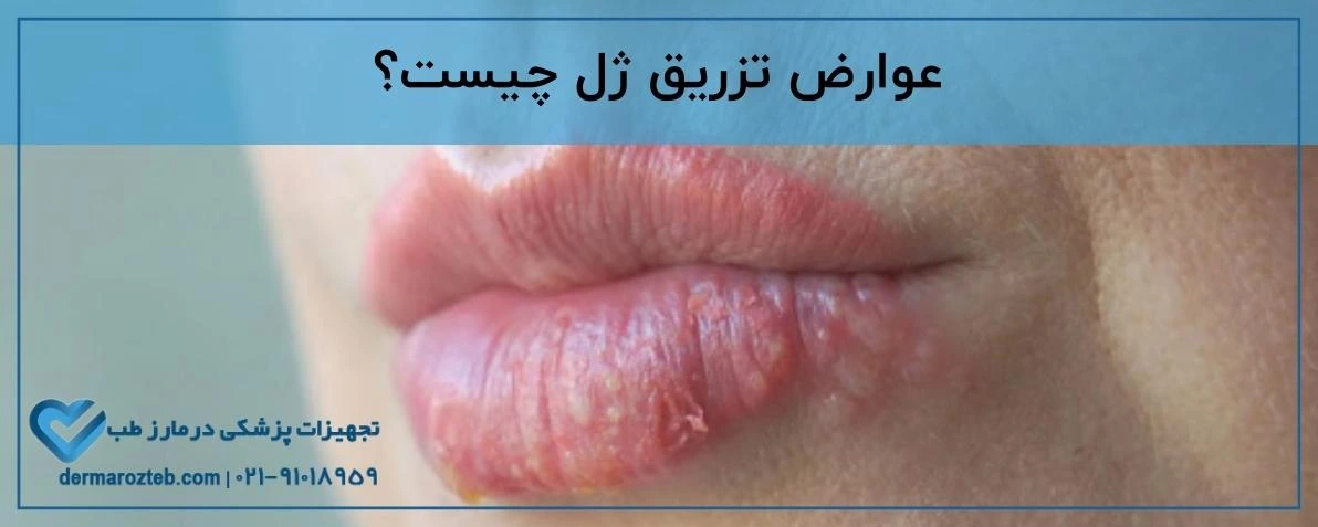 عوارض تزریق ژل چیست؟