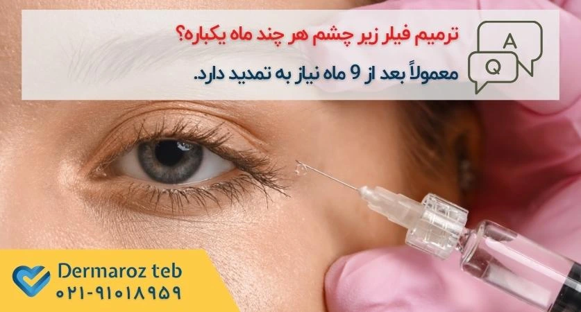 ماندگاری فیلر زیر چشم
