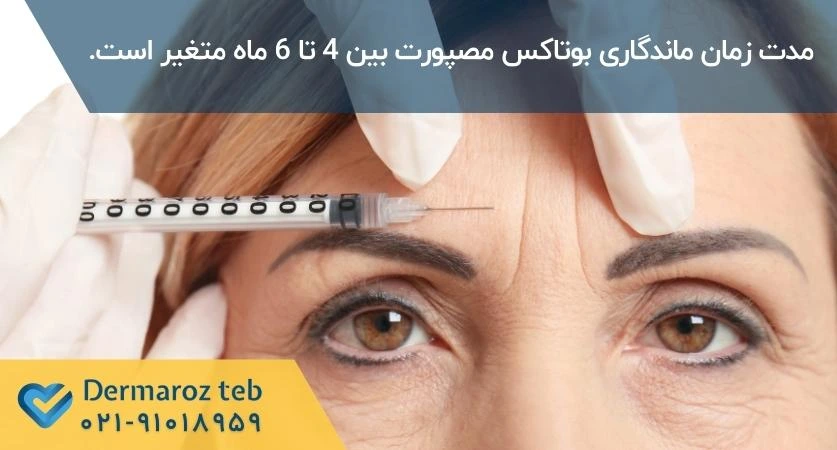 ماندگاری بوتاکس مصپورت