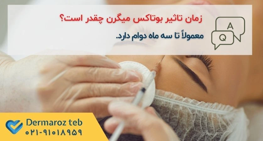 ماندگاری بوتاکس میگرن