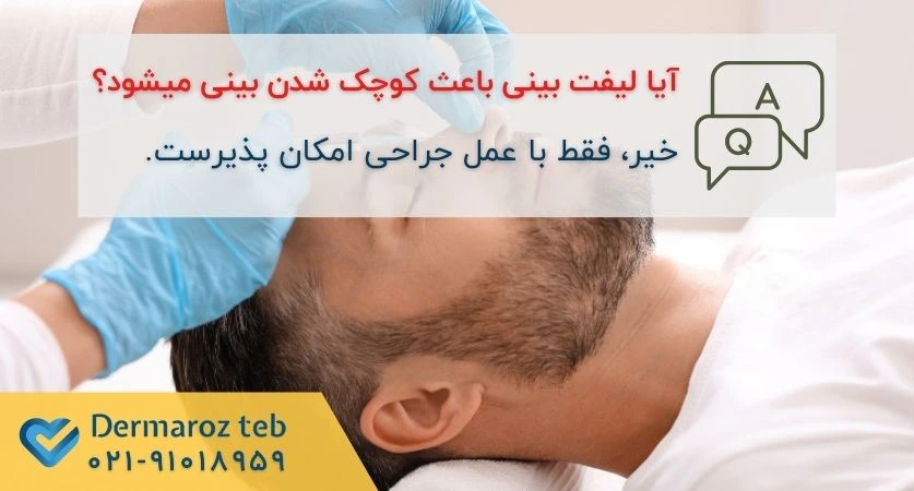 کوچک کردن بینی با لیفت