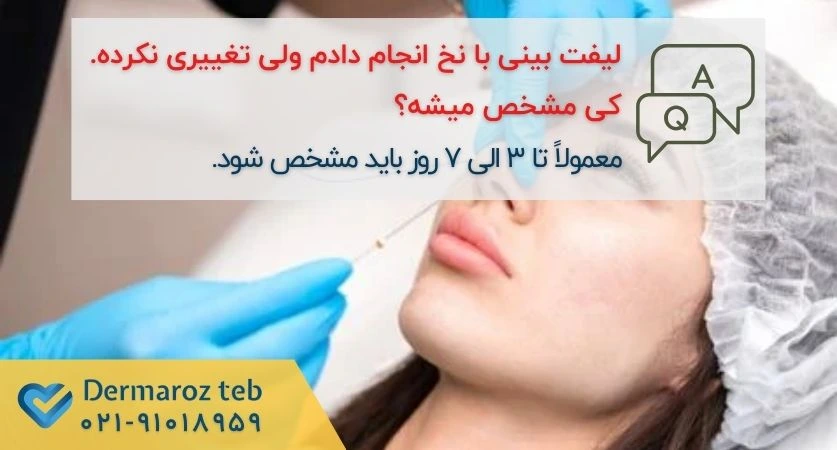 نتیجه لیفت بینی با نخ کی مشخص میشه