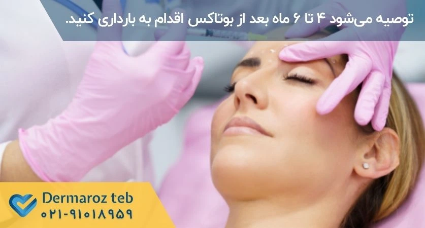 بوتاکس بعد از بارداری