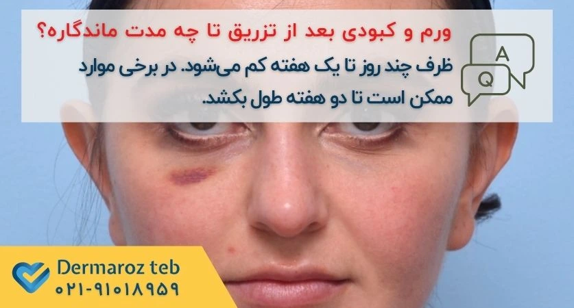 ورم و کبودی بعد از مزوژل