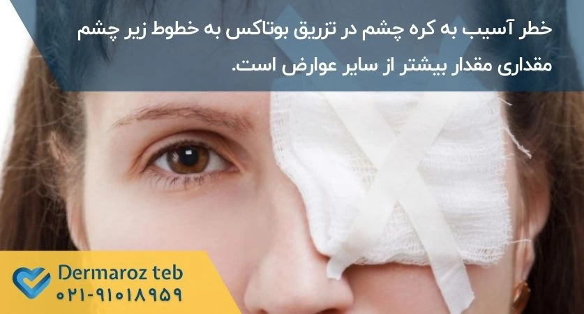 عوارض بوتاکس