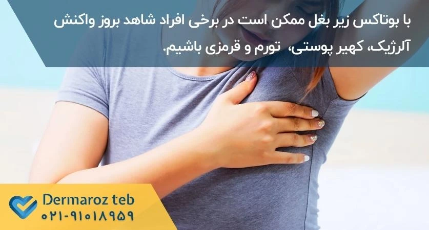 عوارض بوتاکس زیر چشم