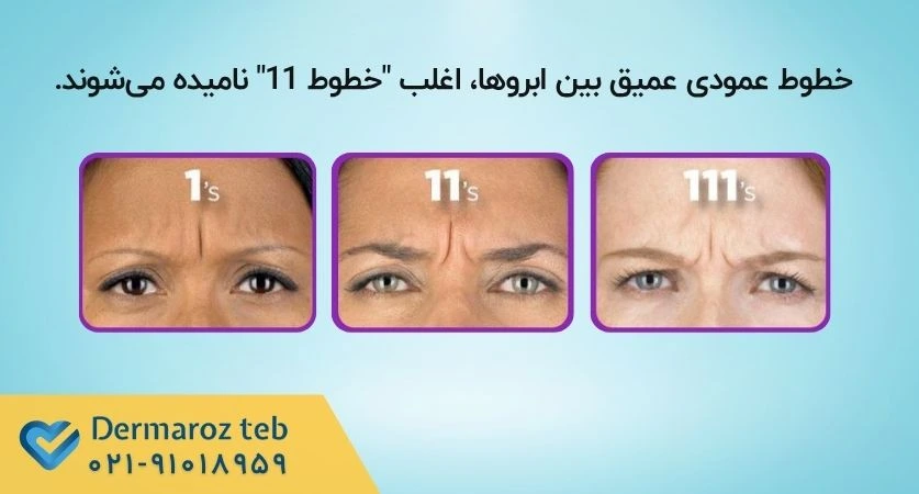 خطوط گلابلا