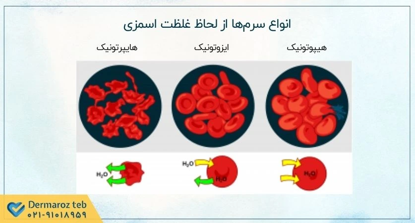 انواع سرمها از لحاظ غلظت اسمزی