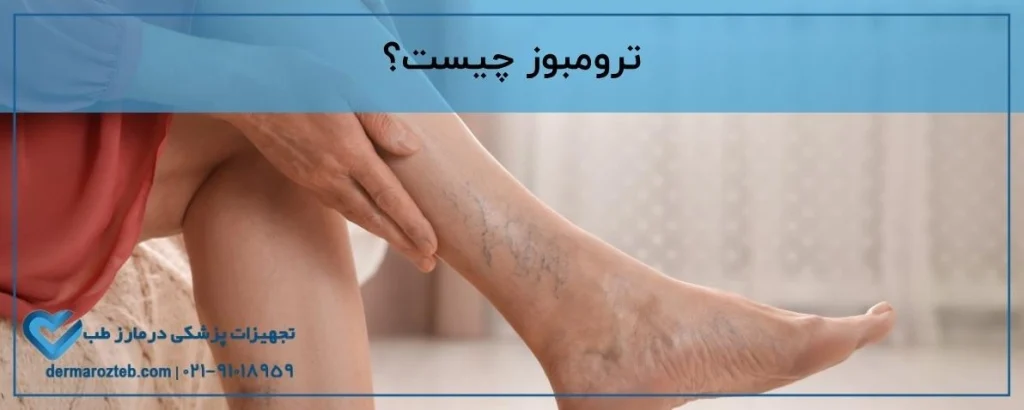ترومبوز چیست