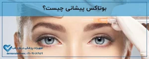 بوتاکس پیشانی چیست؟